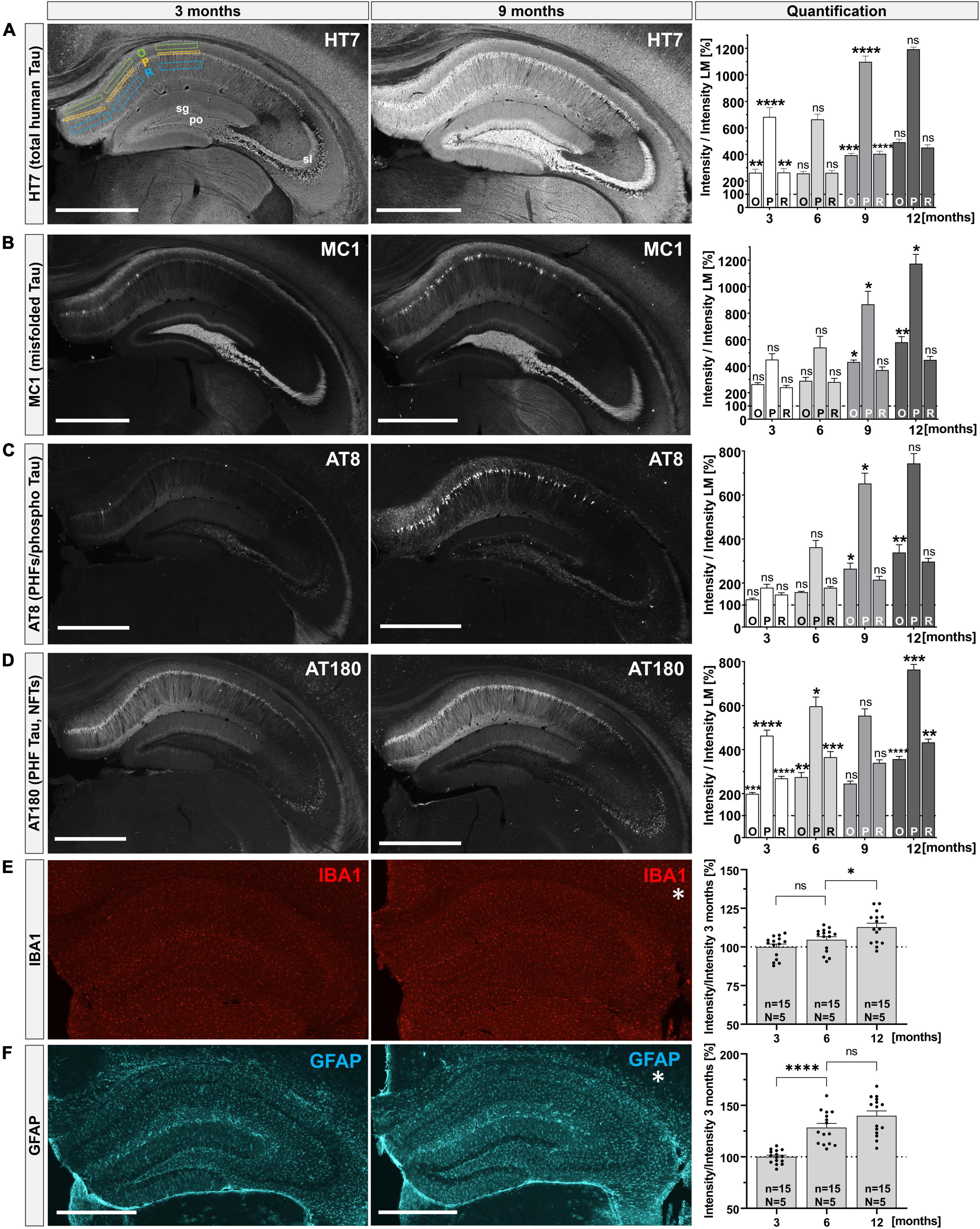 APPsα rescues CDK5 and GSK3β dysregulation and restores normal spine density in Tau transgenic mice